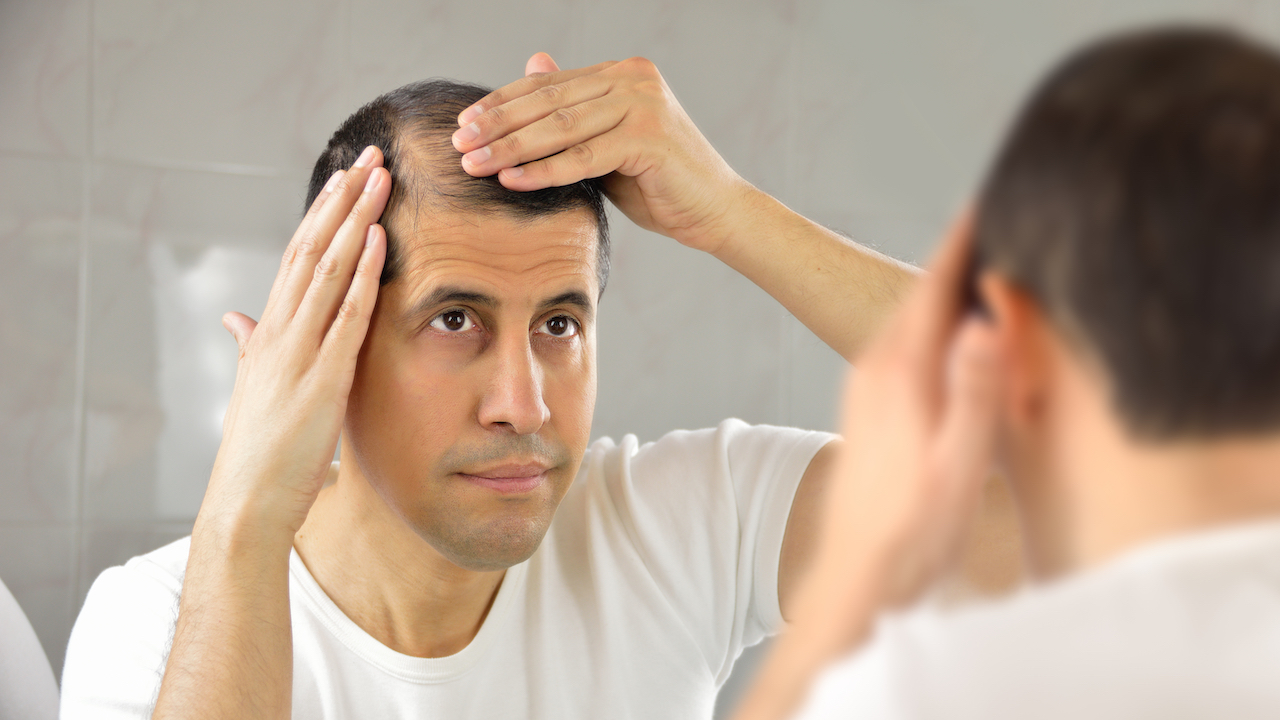 Find an Effective Solution for Hair Loss